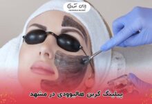 مراقبت بعد از پیلینگ کربن