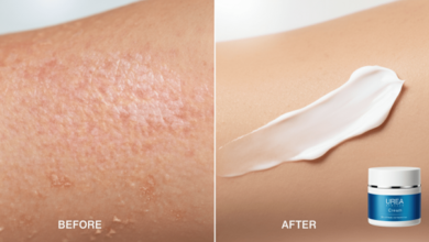 بعد از لیزر چه پمادی بزنیم